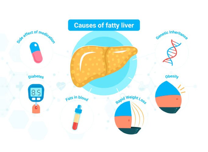 Fatty_Liver