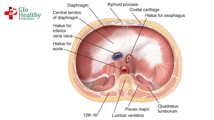 diaphragmatic_hernias