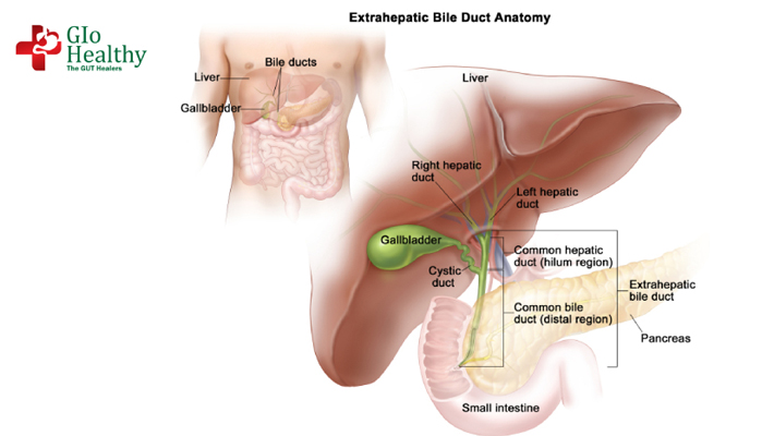 intrahepatic-bile-duct-cancer