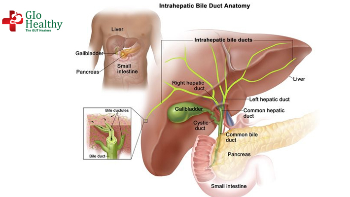 intrahepatic-bile-duct-cancer
