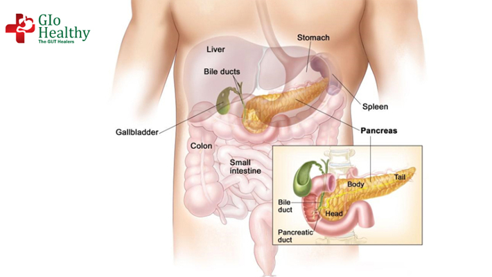 pancreatic-cancer
