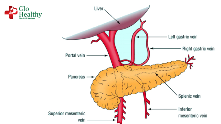 portal-hypertension